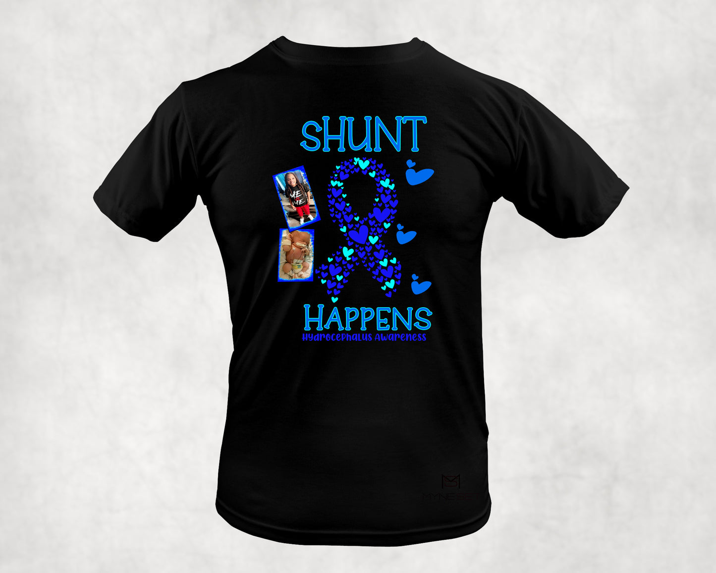 Hydrocephalus Awareness